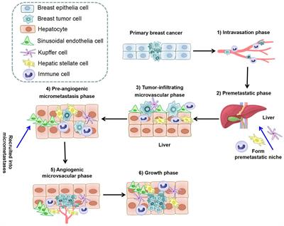 Breast cancer liver metastasis: Pathogenesis and clinical implications